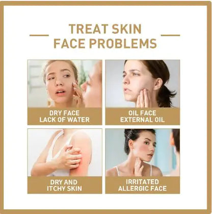 Rice Face Toner - Hydrating &amp; Moisturizing